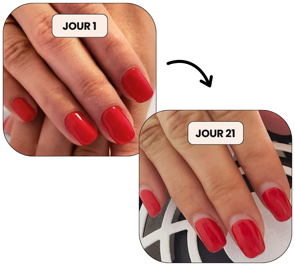 bande vernis gel